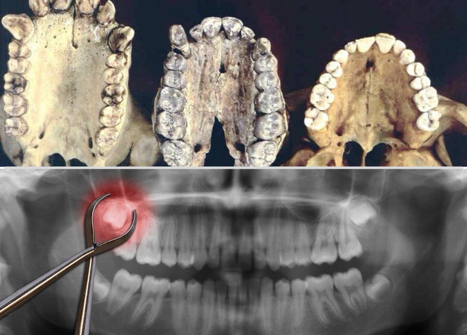 Evoliucija ir protiniai dantys