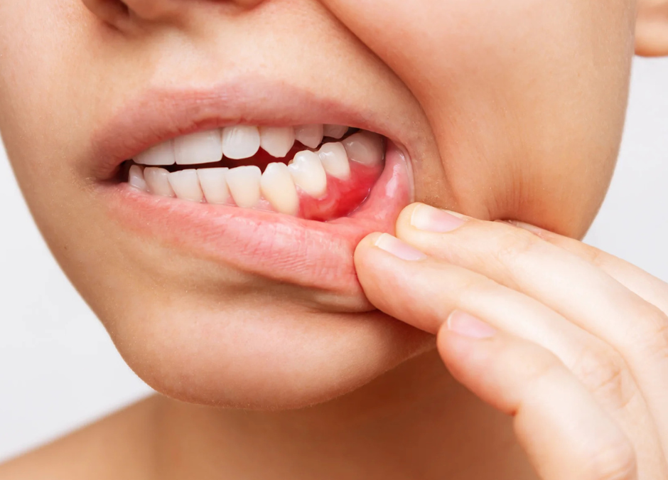 Atnaujintos periodontologinės paslaugos – modernus gydymas ir rūpestis jūsų šypsena