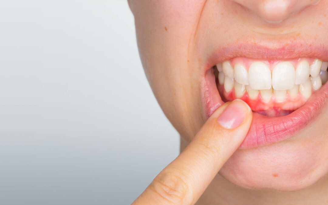 Periodontologė Marijampolėje: šiuolaikinis periodontito gydymas ir priežiūra